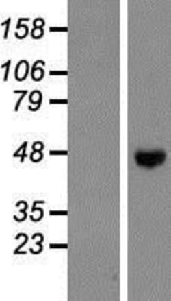 Novus Biologicals&trade;&nbsp;CD39L4/ENTPD5 Overexpression Lysate