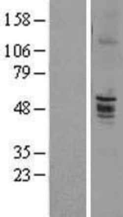Novus Biologicals&trade;&nbsp;CD39L2/ENTPD6 Overexpression Lysate
