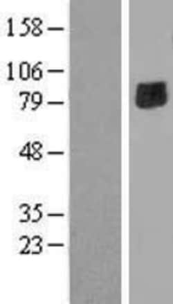 Novus Biologicals&trade;&nbsp;ENTPD7 Overexpression Lysate