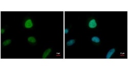 ENY2 Antibody (245), Novus Biologicals 0.1 mL | Buy Online | Novus Biologicals | Fisher Scientific