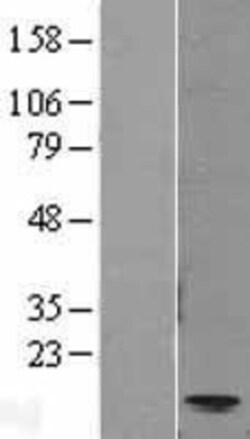 Novus Biologicals&trade;&nbsp;CCL11/Eotaxin Overexpression Lysate