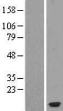 Novus Biologicals&trade;&nbsp;CCL26/Eotaxin-3 Overexpression Lysate