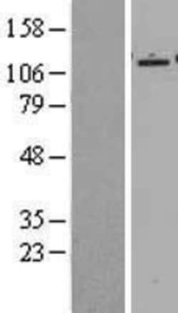 Novus Biologicals&trade;&nbsp;Epac2 Overexpression Lysate