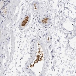 EPB41 Antibody, Novus Biologicals 25 &mu;L; Unlabeled:Antibodies, Polyclonal