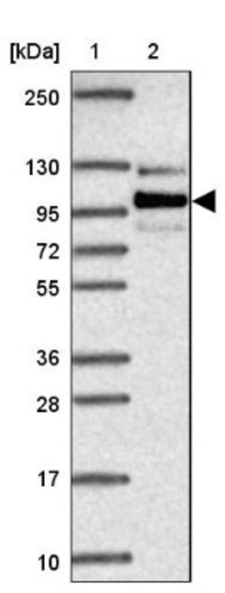 EPB41L1 Antibody, Novus Biologicals:Antibodies:Primary Antibodies