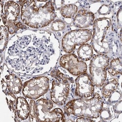 EPB41L3 Antibody, Novus Biologicals 25 &mu;L; Unlabeled:Antibodies, Polyclonal