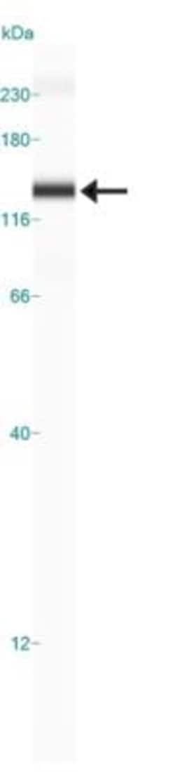 EPB41L3 Antibody - BSA Free, Novus Biologicals 0.025 mL | Buy Online | Novus Biologicals | Fisher Scientific