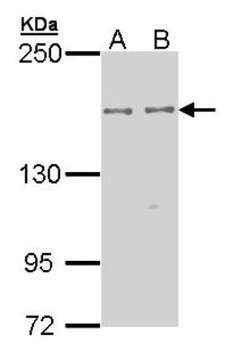 EPB4IL2 Antibody, Novus Biologicals 0.1mL; Unlabeled:Antibodies, Polyclonal