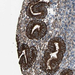 EPB4IL2 Antibody, Novus Biologicals 0.1mL; Unlabeled:Antibodies, Polyclonal