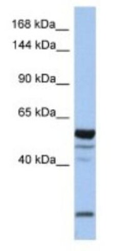 EPB4IL2 Antibody, Novus Biologicals:Antibodies:Primary Antibodies