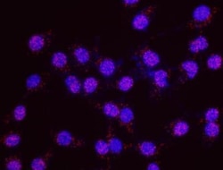 EPC1 Antibody, Novus Biologicals 0.1mg; Unlabeled:Antibodies, Polyclonal
