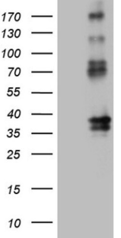 EPCR Antibody (OTI12H5), Novus Biologicals 0.1mL; Unlabeled:Antibodies,