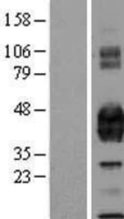 Novus Biologicals&trade;&nbsp;EPCR Overexpression Lysate
