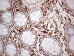 EPCR Antibody (OTI12H5), Novus Biologicals 0.1mL; Unlabeled:Antibodies,