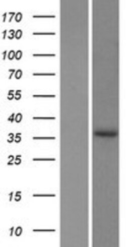 Novus Biologicals&trade;&nbsp;EPDR1 Overexpression Lysate