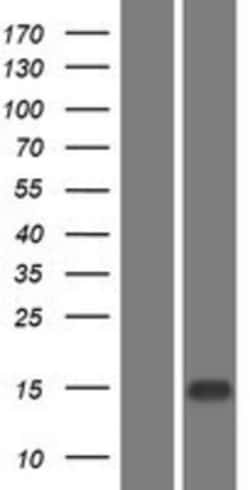 Novus Biologicals&trade;&nbsp;EPGN Overexpression Lysate