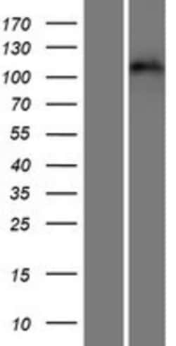 Novus Biologicals&trade;&nbsp;EphA3 Overexpression Lysate