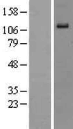 Novus Biologicals&trade;&nbsp;EphA6 Overexpression Lysate