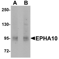 EphA10 Antibody - BSA Free, Novus Biologicals 0.025 mg, Unconjugated:Antibodies,