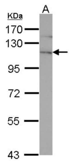 EphA4 Antibody, Novus Biologicals 0.1mL; Unlabeled:Antibodies, Polyclonal