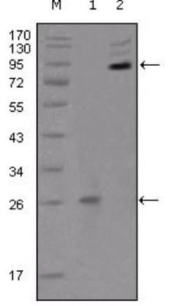 EphB2 Antibody (2D12C6), Novus Biologicals 0.1mL; Unlabeled:Antibodies,