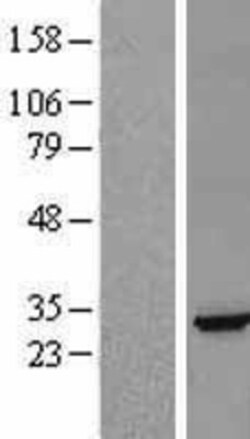 Novus Biologicals&trade;&nbsp;Ephrin-A5 Overexpression Lysate