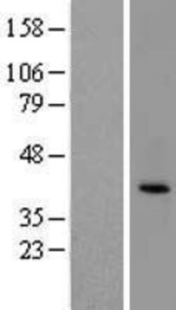 Novus Biologicals&trade;&nbsp;Ephrin-B2 Overexpression Lysate