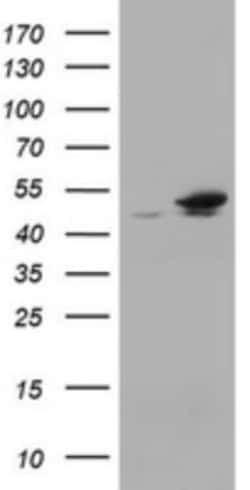 EPHX1 Antibody (OTI3F10), Novus Biologicals 0.1mL; Unlabeled:Antibodies,