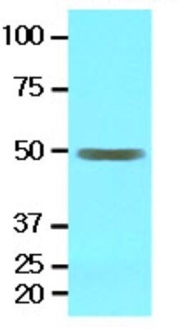 EPHX1 Antibody (2E5) - BSA Free, Novus Biologicals 0.1mL; Unlabeled:Antibodies,