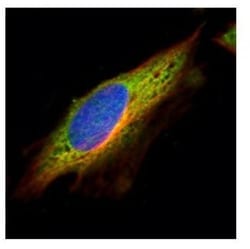 EPHX1 Antibody, Novus Biologicals 0.1mL; Unlabeled:Antibodies, Polyclonal