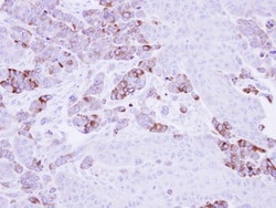 EPHX1 Antibody, Novus Biologicals 0.1mL; Unlabeled:Antibodies, Polyclonal