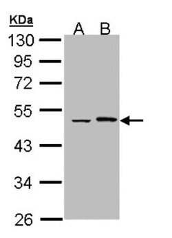 EPHX1 Antibody, Novus Biologicals 0.1mL; Unlabeled:Antibodies, Polyclonal
