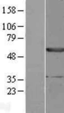 Novus Biologicals&trade;&nbsp;EPHX1 Overexpression Lysate