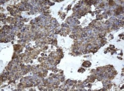 EPHX1 Antibody (OTI3F10), Novus Biologicals 0.1mL; Unlabeled:Antibodies,