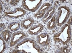 EPHX1 Antibody (OTI3F10), Novus Biologicals 0.1mL; Unlabeled:Antibodies,