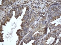 EPHX1 Antibody (OTI3F10), Novus Biologicals 0.1mL; Unlabeled:Antibodies,