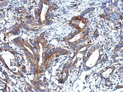 epithelial Sodium Channel alpha Antibody, Novus Biologicals 0.1mL; Unlabeled:Antibodies,
