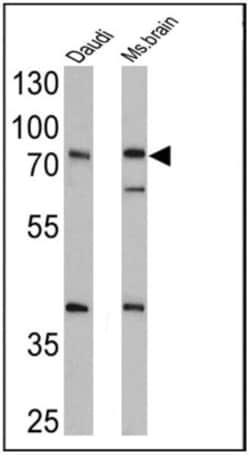 epithelial Sodium Channel alpha Antibody, Novus Biologicals 0.1mg; Unlabeled:Antibodies,