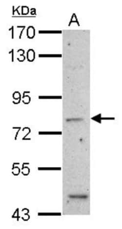 epithelial Sodium Channel alpha Antibody, Novus Biologicals 0.1mL; Unlabeled:Antibodies,