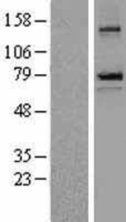 Novus Biologicals&trade;&nbsp;epithelial Sodium Channel beta Overexpression Lysate
