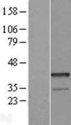 Novus Biologicals&trade;&nbsp;Epithelial Stromal Interaction 1 Overexpression Lysate