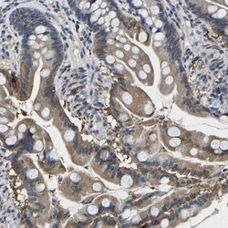 epithelial Sodium Channel beta Antibody, Novus Biologicals 25ul | Buy Online | Novus Biologicals | Fisher Scientific