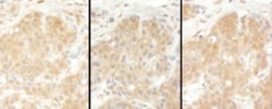 EPRS Antibody, Novus Biologicals 0.1mg; Unlabeled:Antibodies, Polyclonal