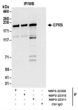 EPRS Antibody, Novus Biologicals 0.1mg; Unlabeled:Antibodies, Polyclonal