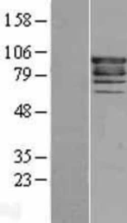 Novus Biologicals™ Eps8 Overexpression Lysate