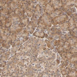 Eps8 Antibody, Novus Biologicals:Antibodies:Primary Antibodies