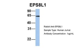 EPS8L1 Antibody, Novus Biologicals 100&mu;L; Unlabeled:Antibodies, Polyclonal