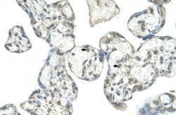 EPS8L1 Antibody, Novus Biologicals 0.1mg; Unlabeled:Antibodies, Polyclonal
