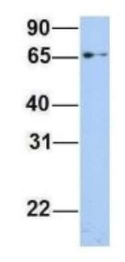 EPS8L1 Antibody, Novus Biologicals 100&mu;L; Unlabeled:Antibodies, Polyclonal