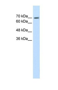 EPS8L1 Antibody, Novus Biologicals 0.1mg; Unlabeled:Antibodies, Polyclonal